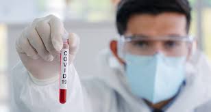 Personas con coronavirus más propensos a sufrir  derrames cerebrales